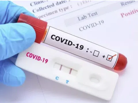 Không yêu cầu người dân trình kết quả xét nghiệm COVID-19 khi vào địa bàn tỉnh, thành phố